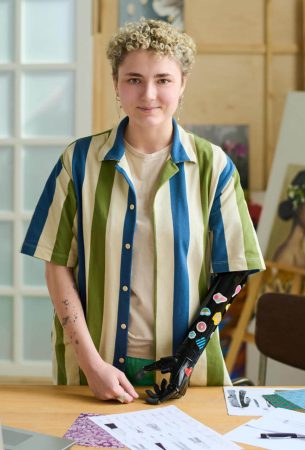 young-female-with-myoelectric-arm-decorated-with-s-2025-03-15-11-45-06-utc